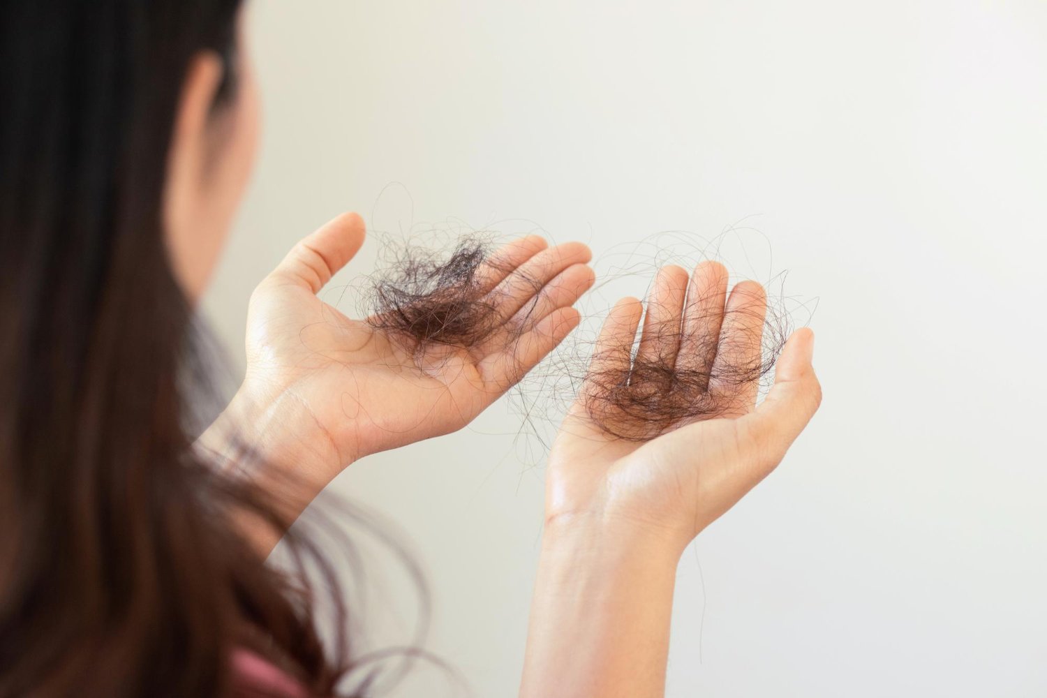 Addressing Female Hair Loss